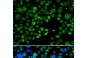 Immunofluorescence analysis of MCF-7 cells using TXNDC5 Polyclonal Antibody (TXNDC5 抗体)
