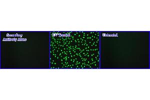 DNA Damage Induced by UV Light in Hela Cells. (Cellular UV-Induced DNA Damage ELISA 试剂盒)