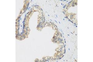 Immunohistochemistry of paraffin-embedded human prostate using NCBP2 antibody. (NCBP2 抗体  (AA 1-156))