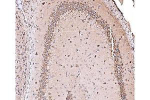 IHC analysis of ORP150/HYOU1 using anti-ORP150/HYOU1 antibody (ABIN7601807). (HYOU1 抗体  (AA 46-913))