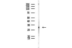 anti-Histone Cluster 1, H1t (HIST1H1T) (Internal Region) antibody