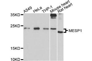 Western blot analysis of extracts of various cells, using MESP1 antibody. (MESP1 抗体)