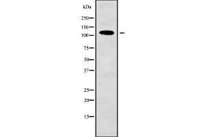 Western blot analysis of ASAP2 using LOVO whole cell lysates