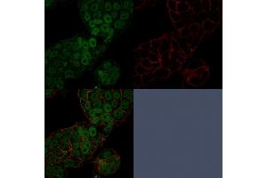 Confocal immunofluorescence image of MCF-7 cells using CHD4 Mouse Monoclonal Antibody (3F2/4) stained in Green (CF488) and Phalloidin is used to label the membranes. (CHD4 抗体  (C-Term))