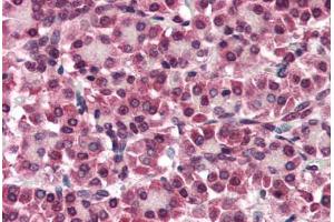 Human Pancreas (formalin-fixed, paraffin-embedded) stained with GPC4 antibody ABIN351425 at 5-10 ug/ml followed by biotinylated goat anti-rabbit IgG secondary antibody ABIN481713, alkaline phosphatase-streptavidin and chromogen. (GPC4 抗体  (Internal Region))