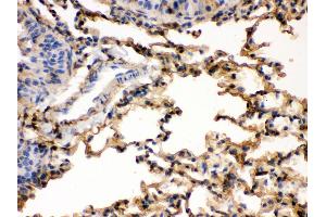 Immunohistochemistry (Paraffin-embedded Sections) (IHC (p)) image for anti-S100 Calcium Binding Protein A6 (S100A6) (AA 1-90) antibody (ABIN3043320) (S100A6 抗体  (AA 1-90))