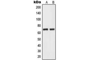 Western blot analysis of NEIL3 expression in human testis (A), HepG2 (B) whole cell lysates.