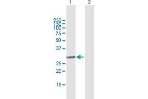 Western Blot analysis of SMNDC1 expression in transfected 293T cell line by SMNDC1 MaxPab polyclonal antibody. (SMNDC1 抗体  (AA 1-238))