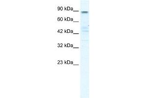 WB Suggested Anti-KCNQ2 Antibody Titration:  0. (KCNQ2 抗体  (N-Term))