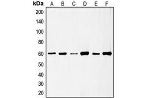 Western blot analysis of c-SRC (pS75) expression in HeLa (A), HuvEc (B), Jurkat (C), COLO205 (D), HEK293T EGF-treated (E), A431 pervanadate-treated (F) whole cell lysates. (Src 抗体  (N-Term, pSer75))