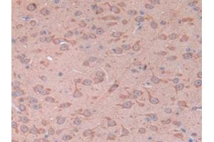 IHC-P analysis of Mouse Cerebrum Tissue, with DAB staining. (CD38 抗体  (AA 54-301))