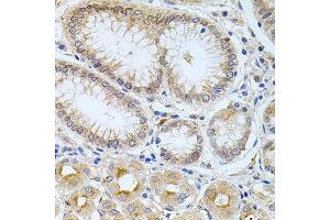 Immunohistochemistry of paraffin-embedded human stomach using CPM antibody at dilution of 1:100 (x40 lens). (CPM 抗体)