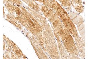 ABIN6274975 at 1/100 staining human skeletal muscle tissue sections by IHC-P. (CPT1B 抗体  (Internal Region))