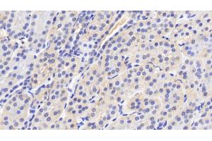 Immunohistochemistry (IHC) image for anti-Peptidylprolyl Isomerase A (Cyclophilin A) (PPIA) (AA 2-165) antibody (ABIN7432961)