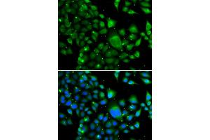Immunofluorescence analysis of MCF-7 cells using WBSCR22 antibody (ABIN4905616). (WBSCR22 抗体)
