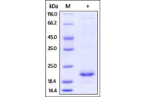 Mouse IL-10, His Tag on SDS-PAGE under reducing (R) condition. (IL-10 Protein (AA 19-178) (His tag))