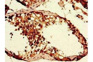 Immunohistochemistry of paraffin-embedded human testis tissue using ABIN7152373 at dilution of 1:100 (CAPZA1 抗体  (AA 211-252))