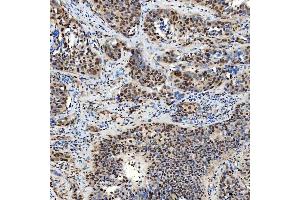 IHC analysis of SMARCA2/BRM using anti-SMARCA2/BRM antibody (ABIN7601969).