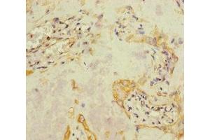 Immunohistochemistry of paraffin-embedded human placenta tissue using ABIN7157836 at dilution of 1:100 (A4GALT 抗体  (AA 244-353))