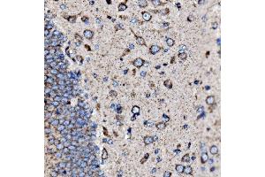 IHC analysis of 5HT1B/HTR1B using anti-5HT1B/HTR1B antibody (ABIN7601425).