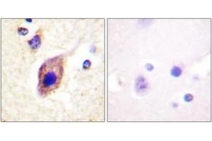 Immunohistochemistry analysis of paraffin-embedded human brain tissue, using PLCG2 (Ab-1217) Antibody. (Phospholipase C gamma 2 抗体  (AA 1186-1235))