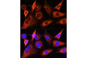 Immunofluorescence analysis of NIH-3T3 cells using PS Rabbit pAb (ABIN6132524, ABIN6146286, ABIN6146288 and ABIN6222421) at dilution of 1:100 (40x lens). (PSAT1 抗体  (AA 1-370))