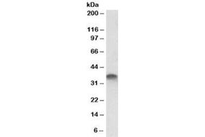 Western blot testing of placenta lysate with STX11 antibody at 1ug/ml. (Syntaxin 11 抗体)