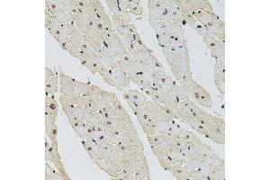 Immunohistochemistry of paraffin-embedded rat heart using HIST1H2AG antibody (ABIN6003627) at dilution of 1/100 (40x lens). (HIST1H2AG 抗体)