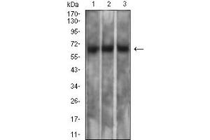 Western blot analysis using MSLN mouse mAb against PC-3 (1), SK-MES-1 (2), and CHO3D10 (3) cell lysate. (Mesothelin 抗体  (AA 296-606))