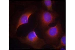 Image no. 3 for anti-Cyclin-Dependent Kinase 6 (CDK6) (pTyr13) antibody (ABIN401597) (CDK6 抗体  (pTyr13))