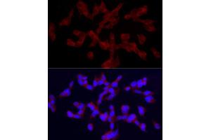 Immunofluorescence analysis of SH-SY5Y cells using TRPC5 Rabbit pAb (ABIN6128835, ABIN6149578, ABIN6149579 and ABIN6214219) at dilution of 1:150 (40x lens). (TRPC5 抗体  (AA 764-973))