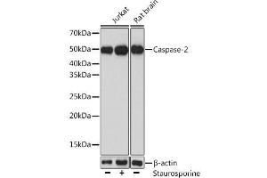 Western blot analysis of extracts of various cell lines using Caspase-2 Polyclonal Antibody at dilution of 1:1000. (Caspase 2 抗体)