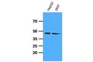 Western Blotting (WB) image for anti-Adenosine Kinase (ADK) antibody (ABIN781539)