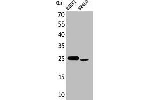 Western Blot analysis of 22RV-1 SW480 cells using SSX Polyclonal Antibody (SSX1 抗体  (C-Term))