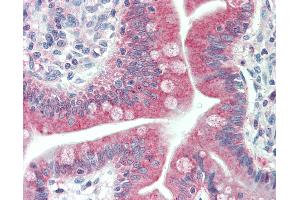 Anti-MAP1LC3C / LC3C antibody IHC staining of human small intestine. (LC3C 抗体  (Thr48))