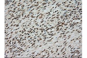 Immunohistochemical staining of paraffin-embedded colon tissue using anti-TYRO3mouse monoclonal antibody. (TYRO3 抗体)
