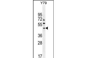 LACE1 Antibody (N-term) (ABIN654572 and ABIN2844276) western blot analysis in Y79 cell line lysates (35 μg/lane). (LACE1 抗体  (N-Term))