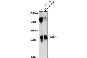 Western blot analysis of extracts of various cell lines, using BRMS1 antibody (ABIN7265929) at 1:1000 dilution. (BRMS1 抗体  (AA 90-210))