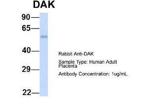 Host: Rabbit  Target Name: DAK  Sample Tissue: Human Adult Placenta  Antibody Dilution: 1. (DAK 抗体  (N-Term))