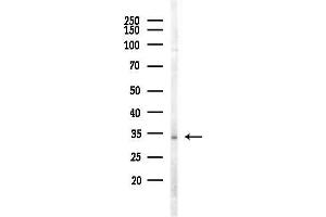 anti-Aminoacyl tRNA Synthetase Complex-Interacting Multifunctional Protein 1 (AIMP1) (Internal Region) antibody