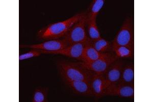 IF analysis of RAP1GDS1 using anti-RAP1GDS1 antibody (ABIN7601725). (RAP1GDS1 抗体  (AA 43-607))