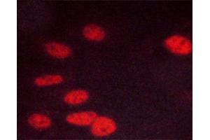 Immunofluorescence (fixed cells) (IF/ICC) image for anti-Cyclin-Dependent Kinase 1 (CDK1) (pThr14) antibody (ABIN6256473)