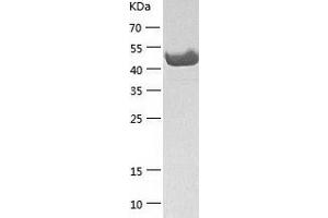 Western Blotting (WB) image for B-Cell Linker (BLNK) (AA 1-456) protein (His tag) (ABIN7288095) (B-Cell Linker Protein (BLNK) (AA 1-456) (His tag))