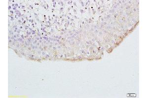 Formalin-fixed and paraffin embedded dog bladder tissue labeled with Anti- CXCL13/BCA1 Polyclonal Antibody, Unconjugated  at 1:200 followed by conjugation to the secondary antibody and DAB (CXCL13 抗体  (AA 23-109))