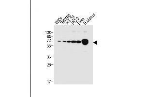 All lanes : Anti-NOX1 Antibody (Center) at 1:1000 dilution Lane 1: WiDr whole cell lysate Lane 2: S whole cell lysate Lane 3: HT-29 whole cell lysate Lane 4: PC-3 whole cell lysate Lane 5: Hela whole cell lysate Lane 6: human uterus tissue lysate Lysates/proteins at 20 μg per lane. (NOX1 抗体  (AA 243-271))
