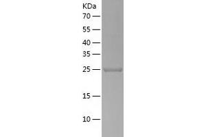 USP33 Protein (AA 71-303) (His tag)