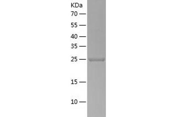 USP33 Protein (AA 71-303) (His tag)