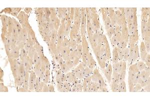 Detection of ADPN in Porcine Cardiac Muscle Tissue using Monoclonal Antibody to Adiponectin (ADPN) (ADIPOQ 抗体  (AA 18-243))