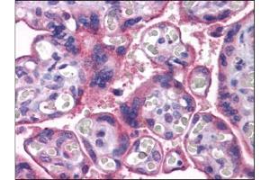 Human Placenta: Formalin-Fixed, Paraffin-Embedded (FFPE) (MFSD2A 抗体  (C-Term))