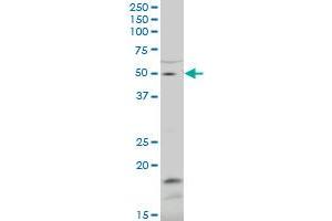 ZNF83 polyclonal antibody (A01), Lot # 051115JC01. (ZNF83 抗体  (AA 1-111))